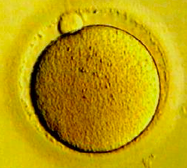 IVF Embryo Transfer