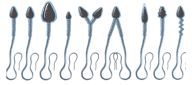 Fertility Investigations-Semen Samples